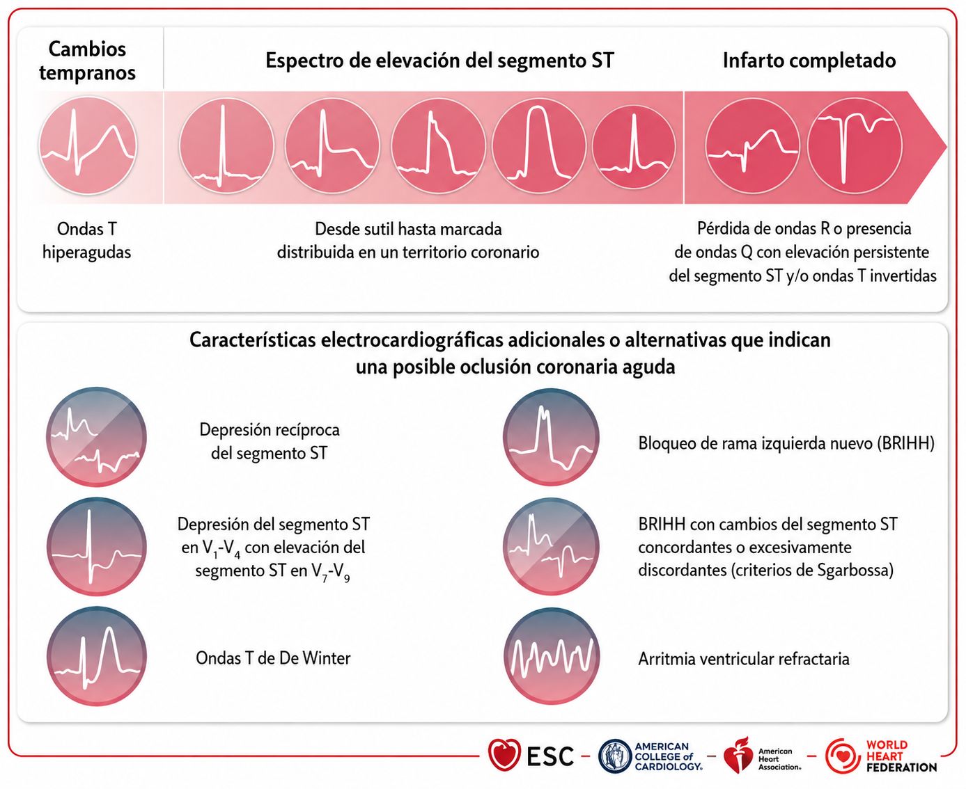 Fig 5. Cambios electrocardiograficos de oclusión coronaria